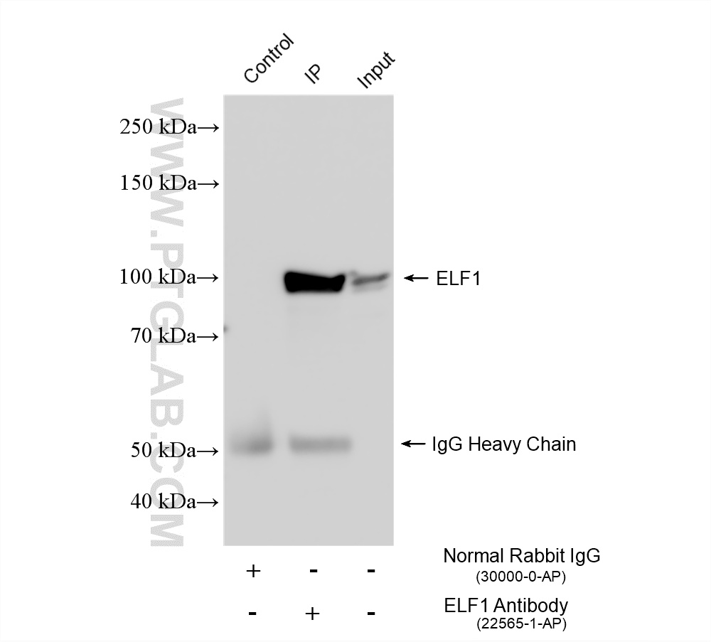 IP experiment of THP-1 using 22565-1-AP