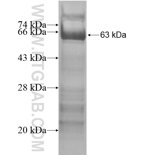 ELF1 fusion protein Ag14248 SDS-PAGE ELF1 fusion protein Ag14248 SDS-PAGE