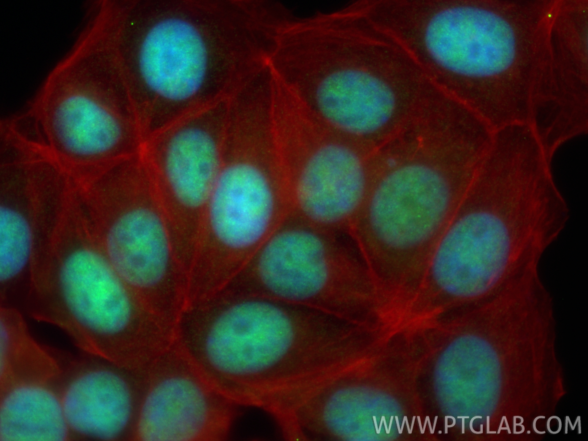 IF Staining of MCF-7 using 12499-1-AP IF Staining of MCF-7 using 12499-1-AP