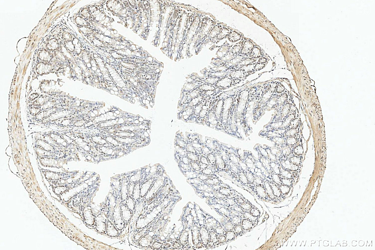 IHC staining of mouse colon using 12499-1-AP IHC staining of mouse colon using 12499-1-AP