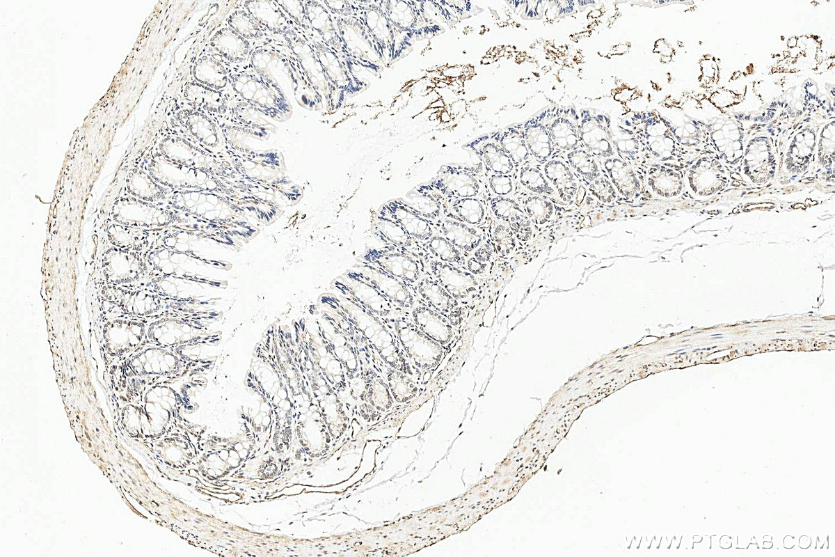 IHC staining of rat colon using 12499-1-AP IHC staining of rat colon using 12499-1-AP
