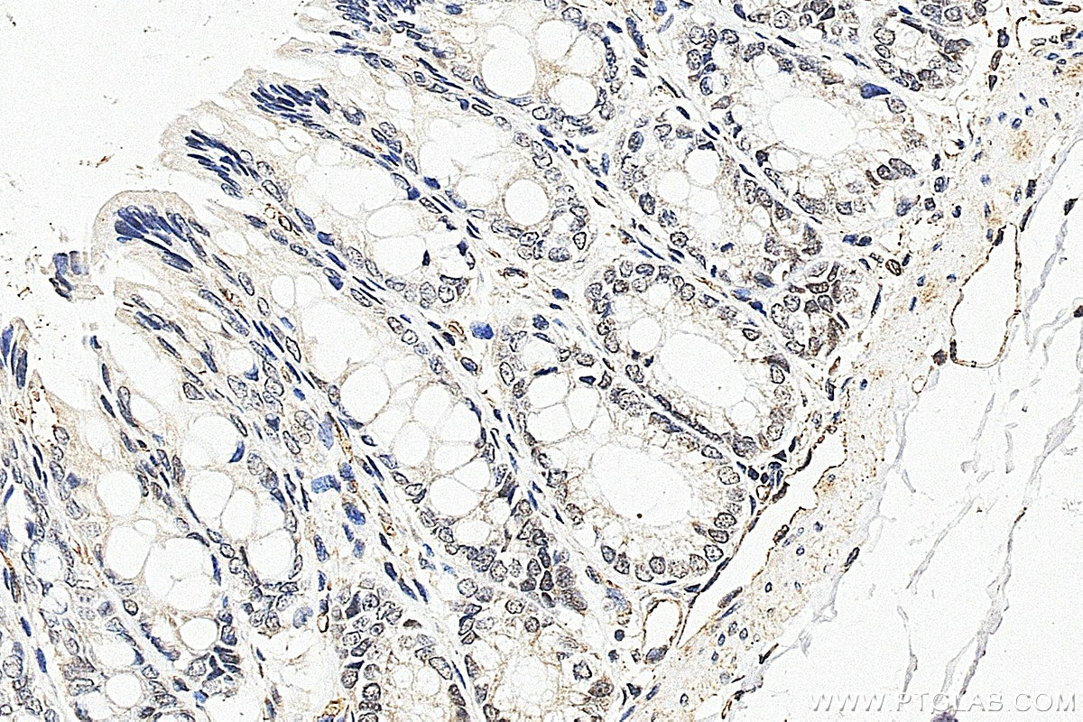 IHC staining of rat colon using 12499-1-AP IHC staining of rat colon using 12499-1-AP