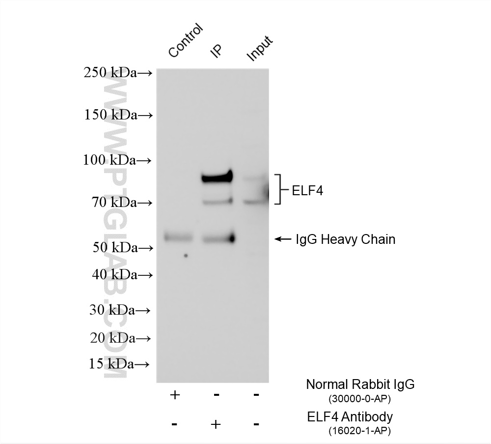 IP experiment of HeLa using 16020-1-AP IP experiment of HeLa using 16020-1-AP