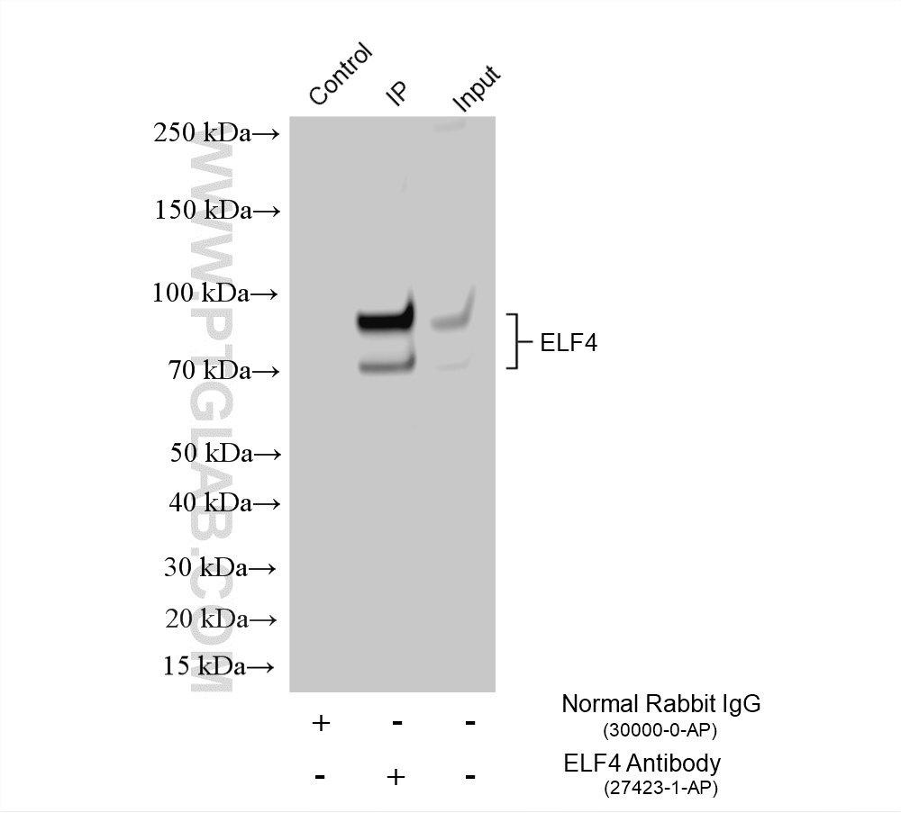 IP experiment of K-562 using 27423-1-AP IP experiment of K-562 using 27423-1-AP