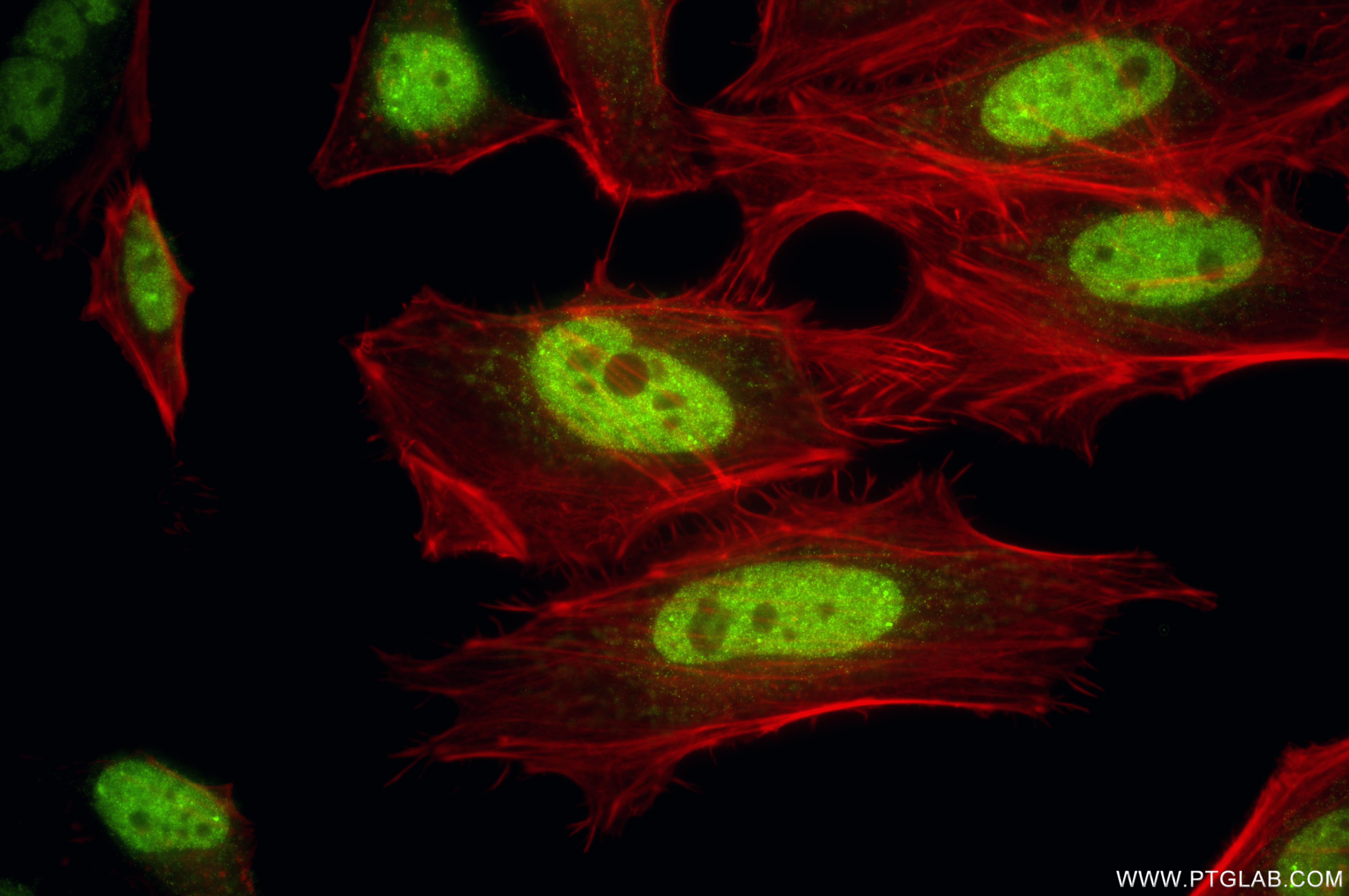 Immunofluorescent analysis of (4% PFA) fixed HeLa cells using ELK1 antibody (<a class='green' href='/productredirect?CatalogNo=87009-2-RR' target='_blank'>87009-2-RR</a>, Clone: 252085B2 ) at dilution of 1:200 and CoraLite®488-Conjugated Goat Anti-Rabbit IgG(H+L) (<a class='green' href='/productredirect?CatalogNo=SA00013-2' target='_blank'>SA00013-2</a>), CL594-Phalloidin (red). This data was developed using the same antibody clone with 87009-2-PBS in a different storage buffer formulation. IF Staining of HeLa using 87009-2-RR (same clone as 87009-2-PBS)