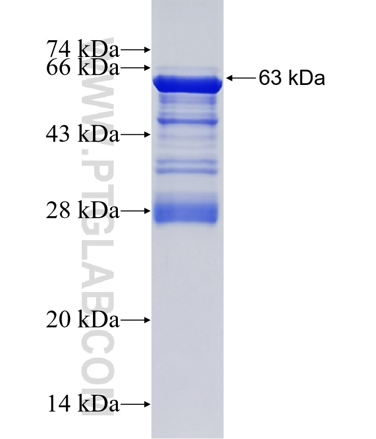 ELK3 fusion protein Ag8936 SDS-PAGE ELK3 fusion protein Ag8936 SDS-PAGE