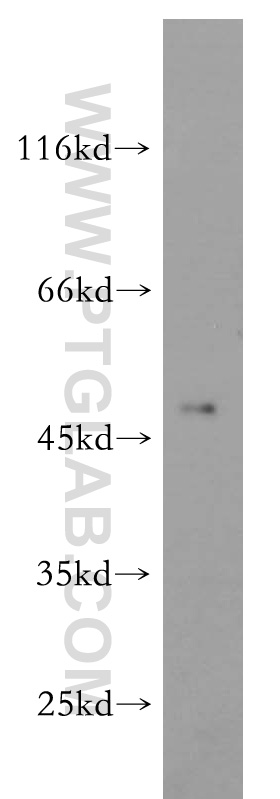 WB analysis of HeLa using 14666-1-AP