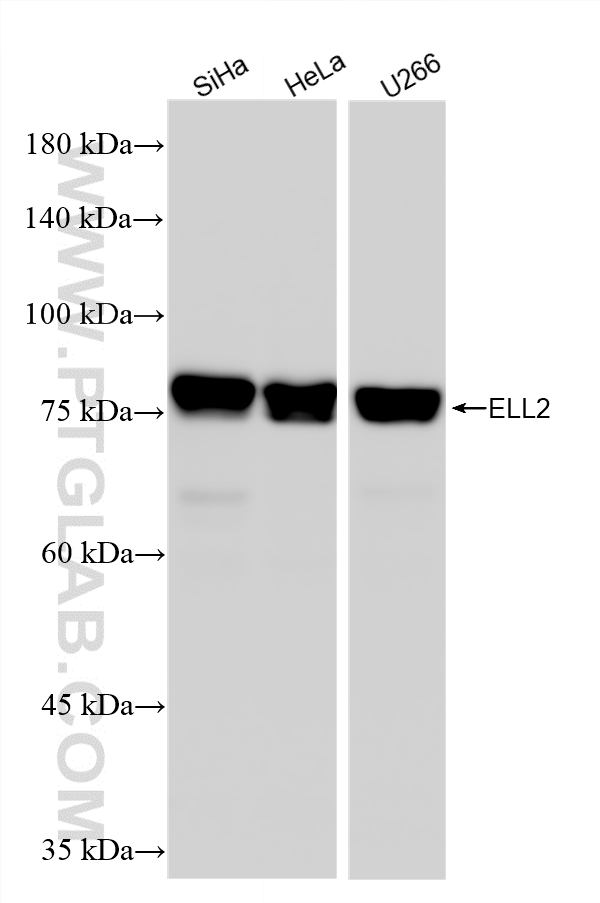 WB analysis using 84226-4-RR (same clone as 84226-4-PBS) WB analysis using 84226-4-RR (same clone as 84226-4-PBS)