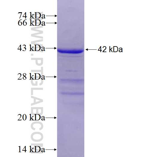 ELL2 fusion protein Ag9135 SDS-PAGE ELL2 fusion protein Ag9135 SDS-PAGE