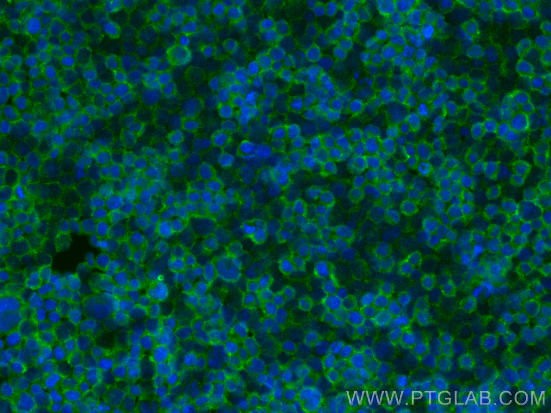 IF Staining of Jurkat using 26974-1-AP