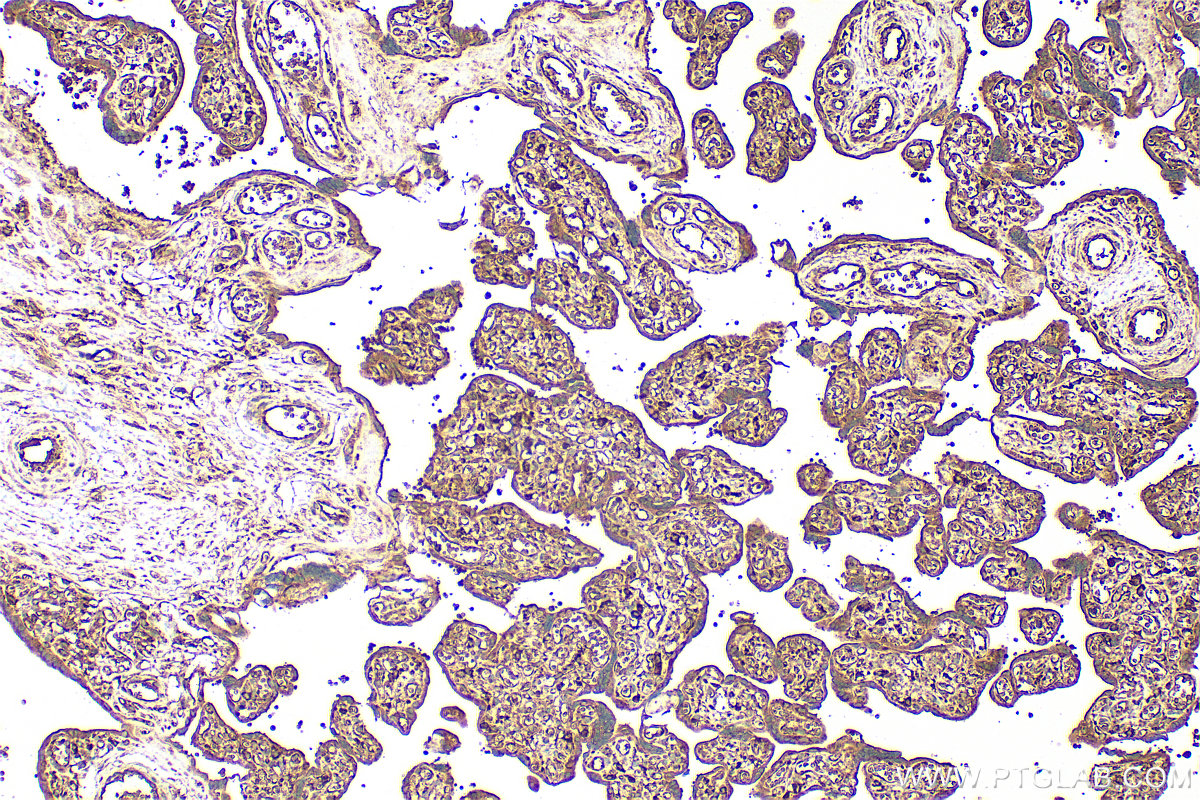 IHC staining of human placenta using 26974-1-AP