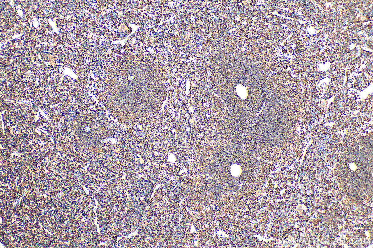 IHC staining of mouse spleen using 26974-1-AP