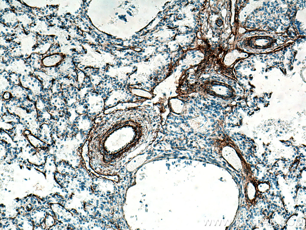 IHC staining of human lung using 15257-1-AP