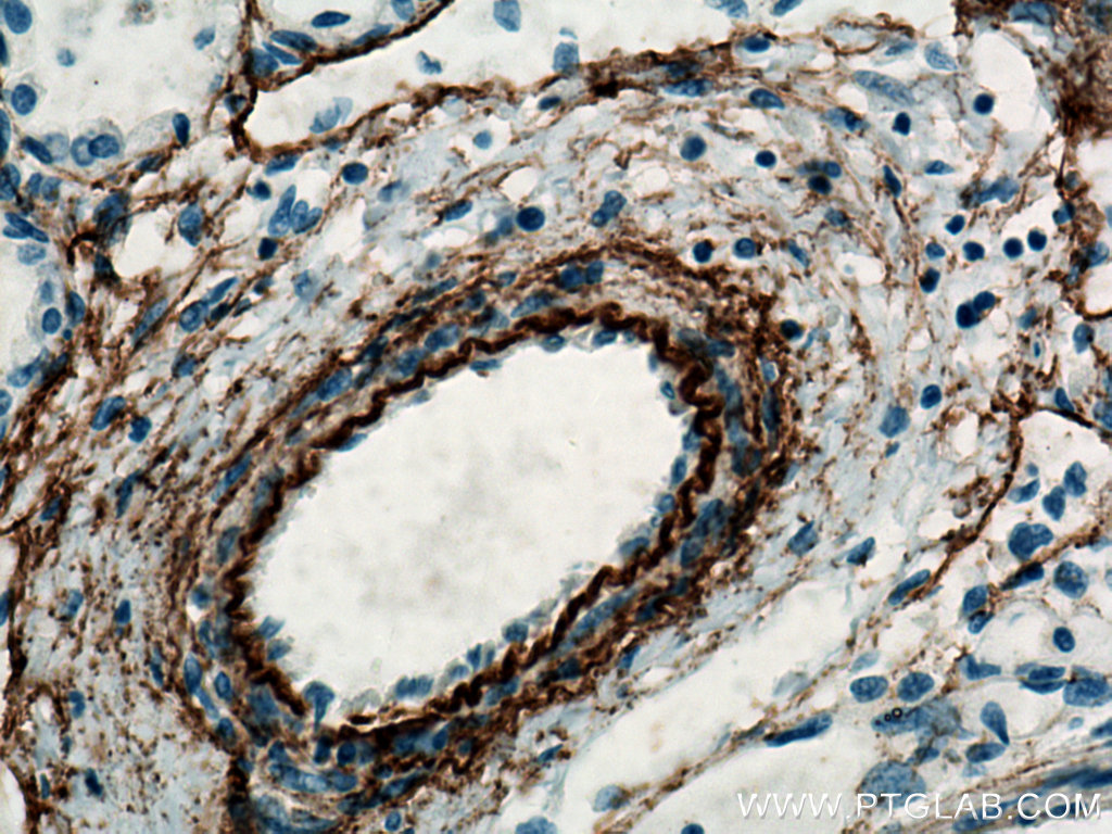 IHC staining of human lung using 15257-1-AP