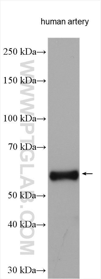 WB analysis using 15257-1-AP