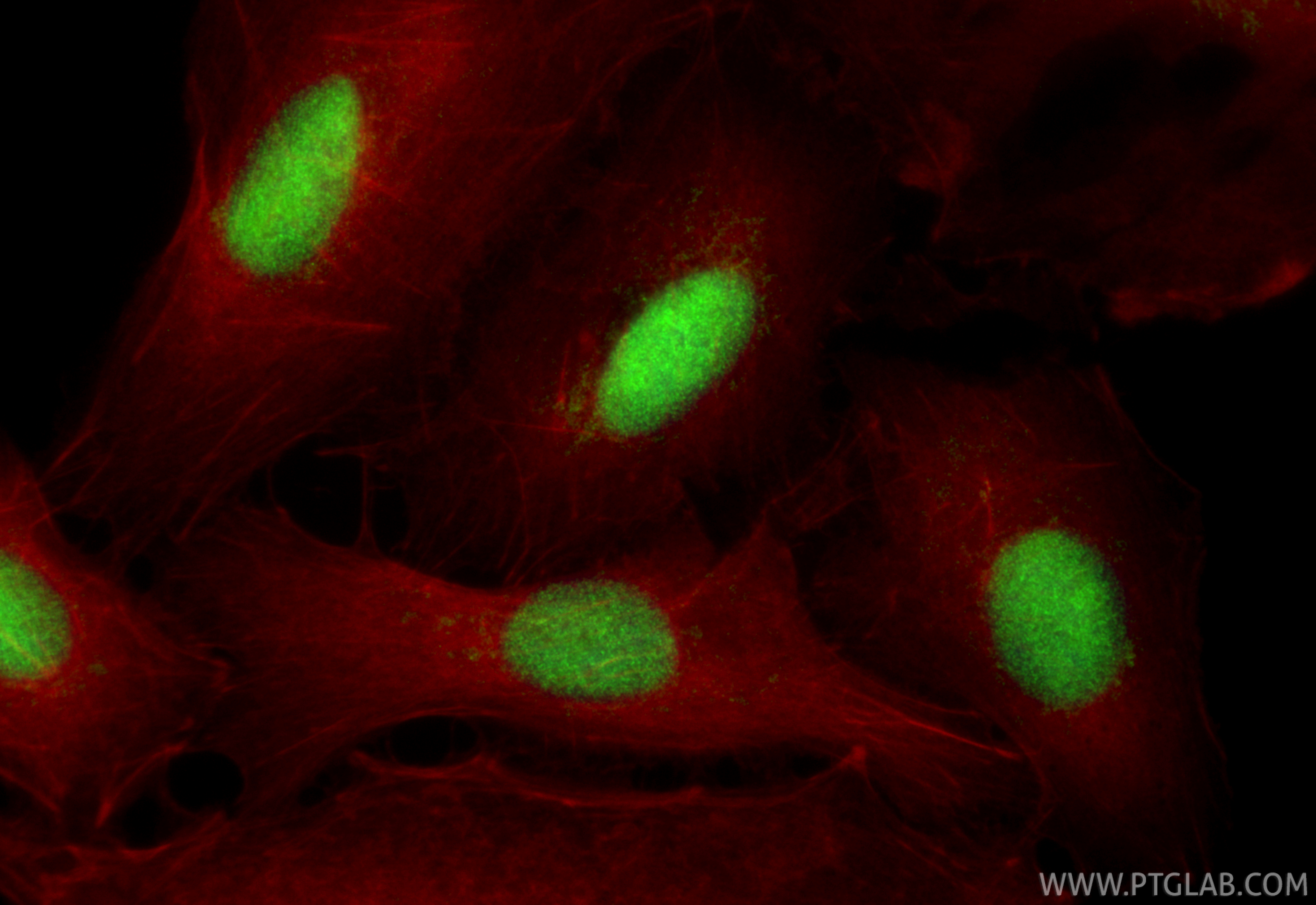 Immunofluorescent analysis of (4% PFA) fixed A549 cells using ELOF1 antibody (21070-1-AP) at dilution of 1:200 and CoraLite®488-Conjugated Goat Anti-Rabbit IgG(H+L) (<a class='green' href='/productredirect?CatalogNo=SA00013-2' target='_blank'>SA00013-2</a>), CL594-Phalloidin (red). IF Staining of A549 using 21070-1-AP