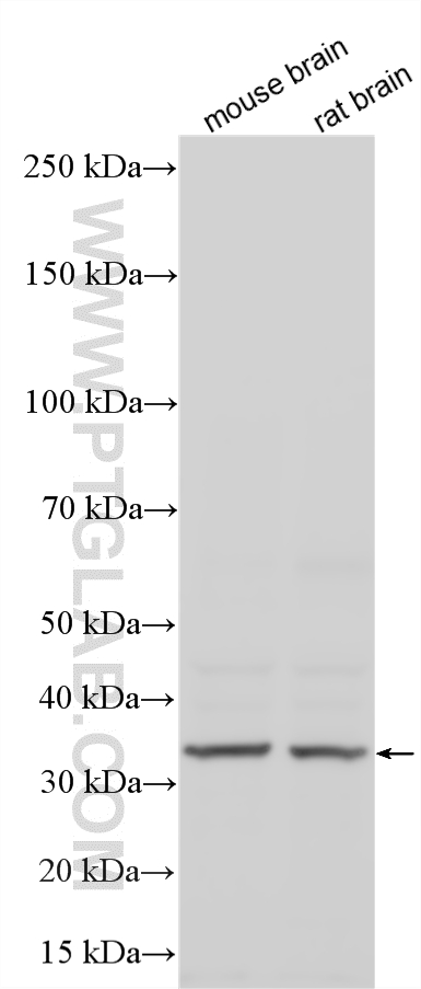 WB analysis using 55023-1-AP WB analysis using 55023-1-AP