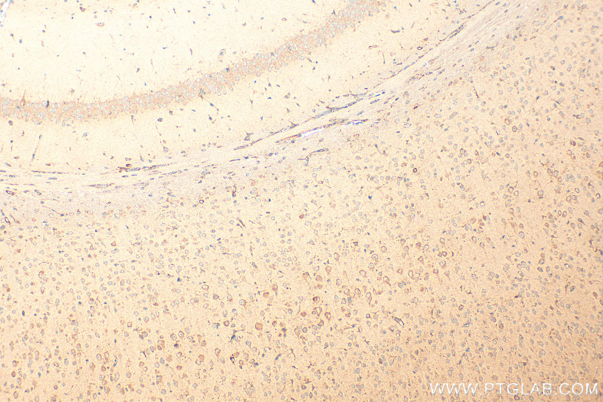 IHC staining of mouse brain using 21160-1-AP