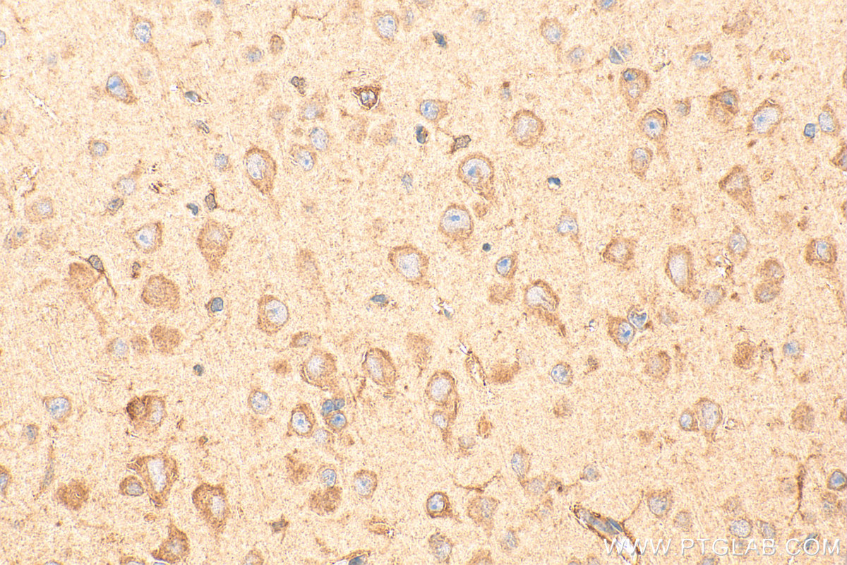 IHC staining of mouse brain using 21160-1-AP