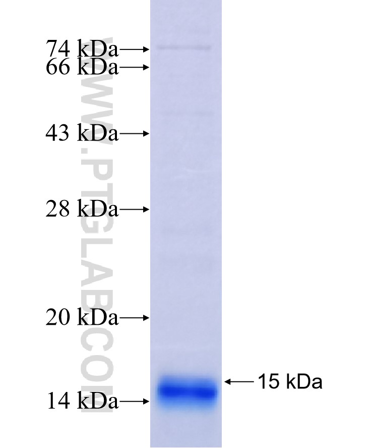 ELOVL6 fusion protein Ag16820 SDS-PAGE