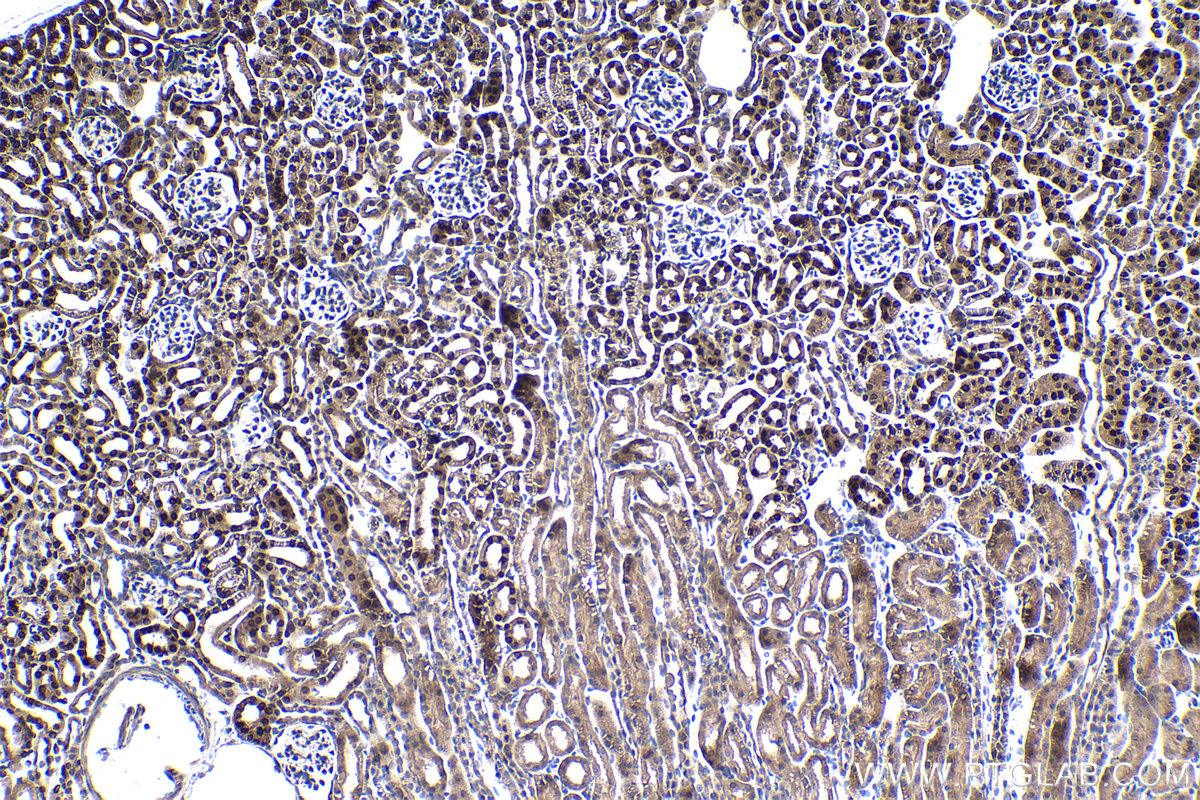 IHC staining of mouse kidney using 13793-1-AP (same clone as 13793-1-PBS)