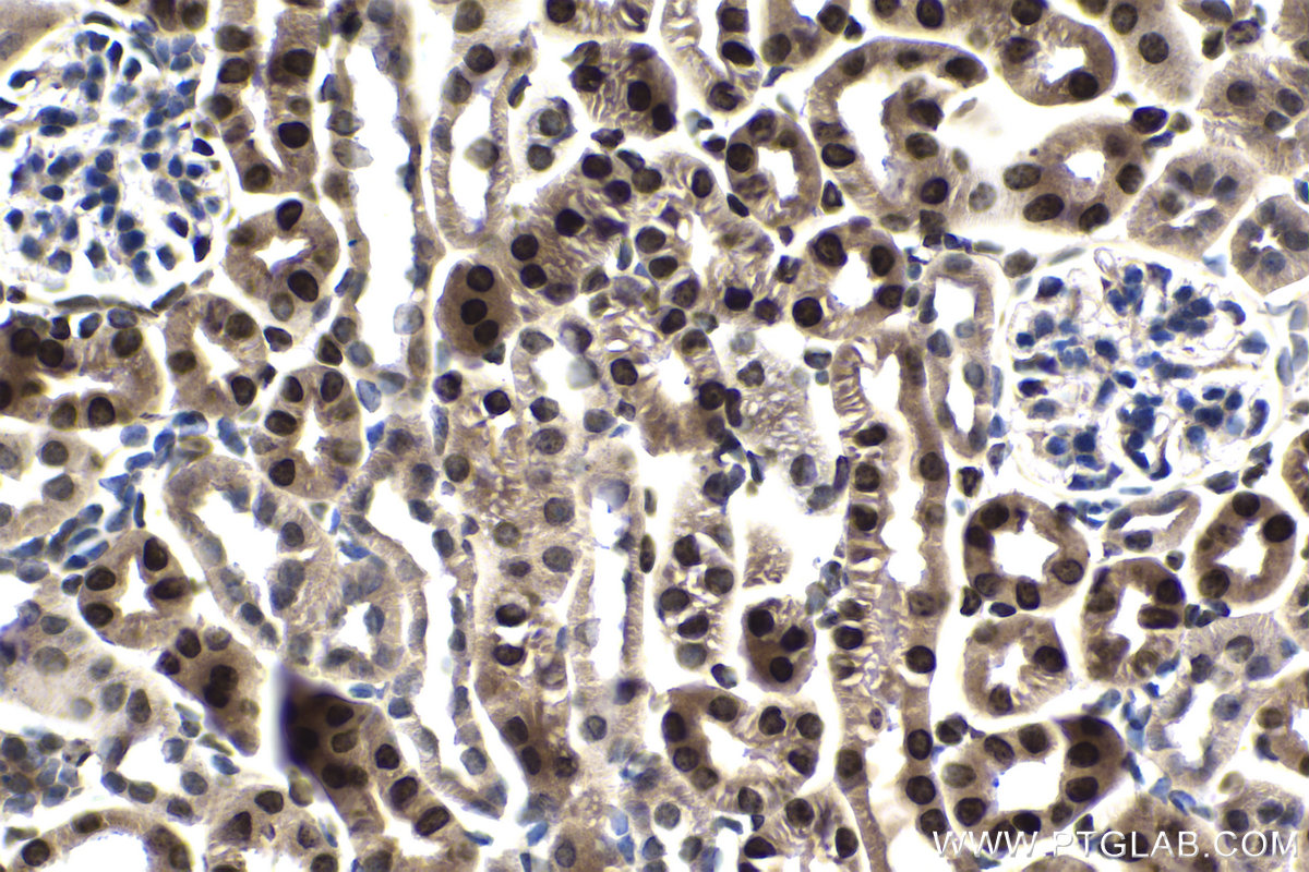 IHC staining of mouse kidney using 13793-1-AP (same clone as 13793-1-PBS)