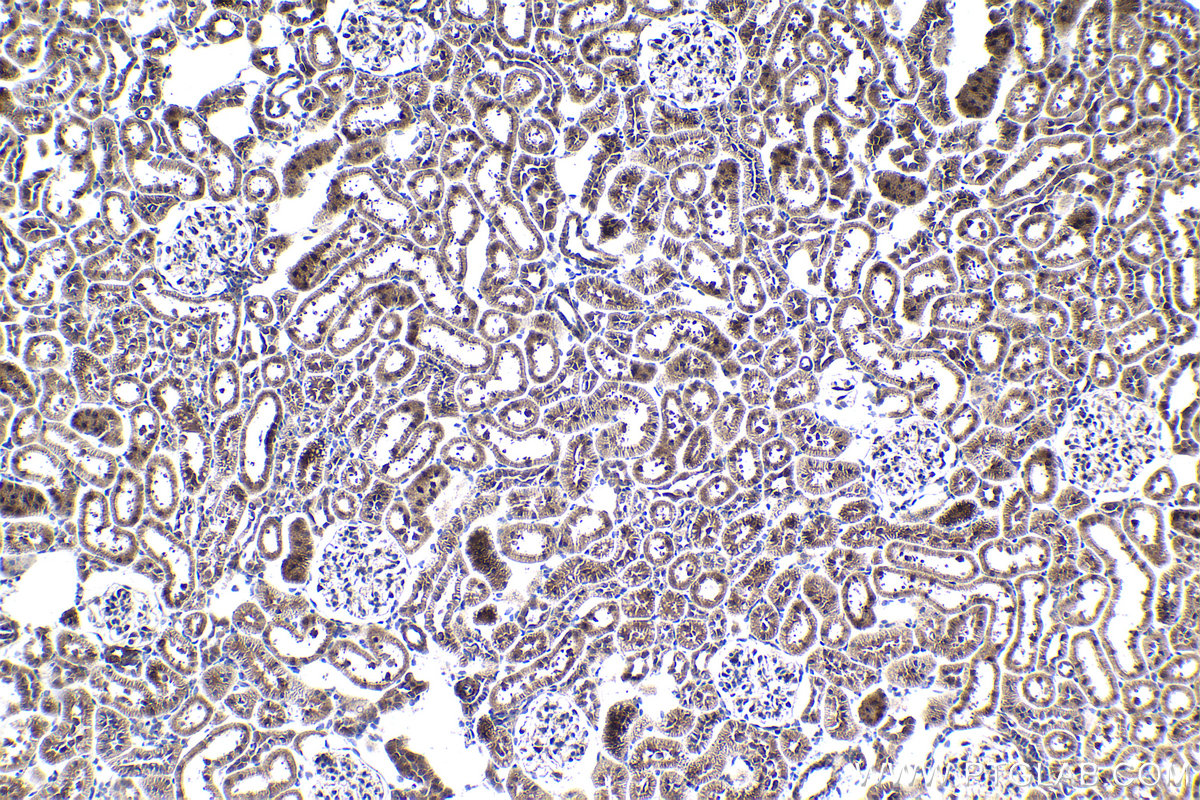 IHC staining of rat kidney using 13793-1-AP (same clone as 13793-1-PBS)