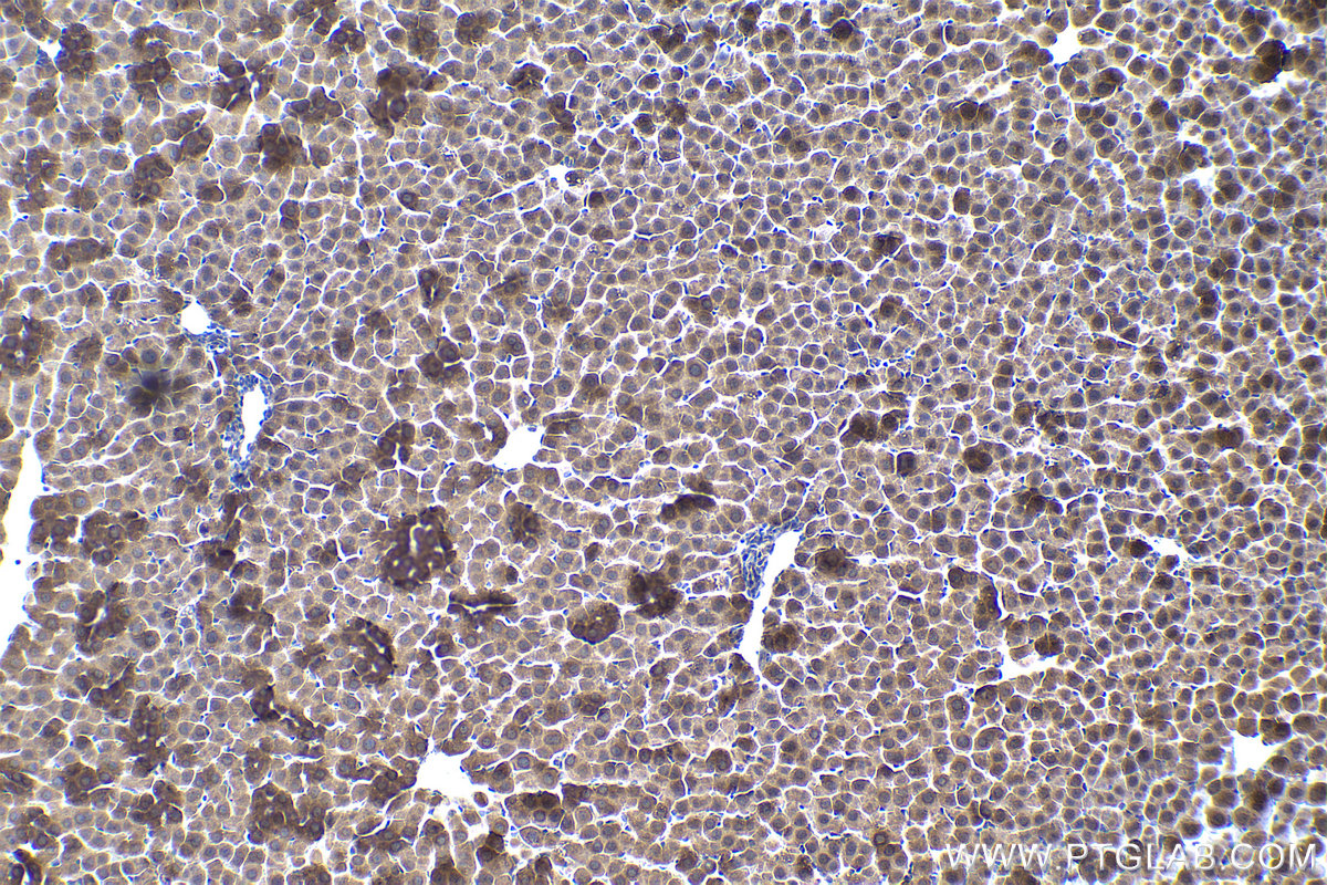 IHC staining of rat liver using 13793-1-AP (same clone as 13793-1-PBS)