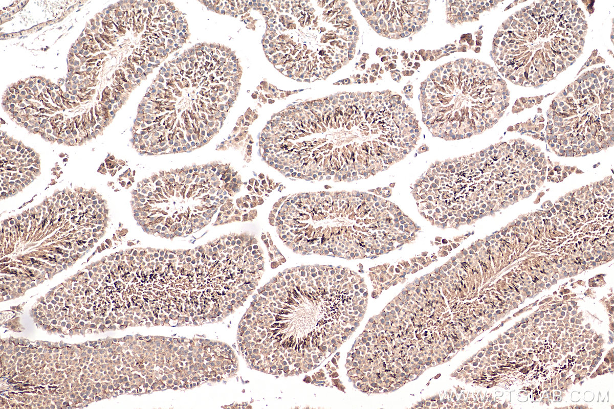 IHC staining of mouse testis using 13946-1-AP (same clone as 13946-1-PBS)
