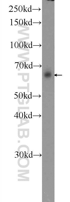WB analysis of HeLa using 13946-1-AP (same clone as 13946-1-PBS)