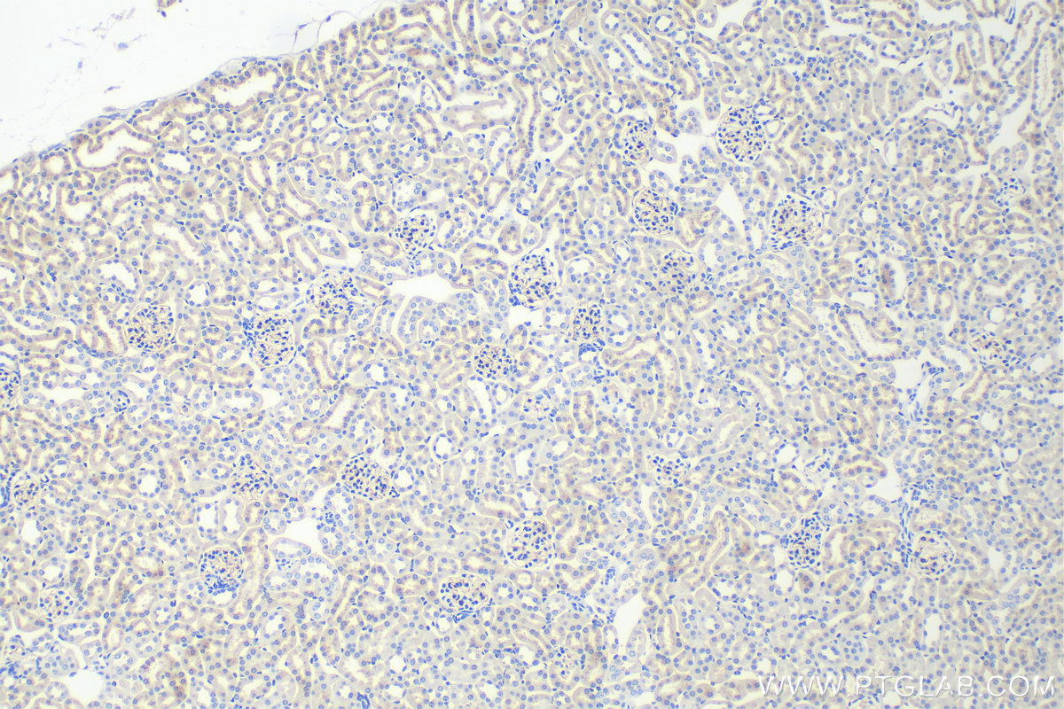 IHC staining of mouse kidney using 11828-1-AP