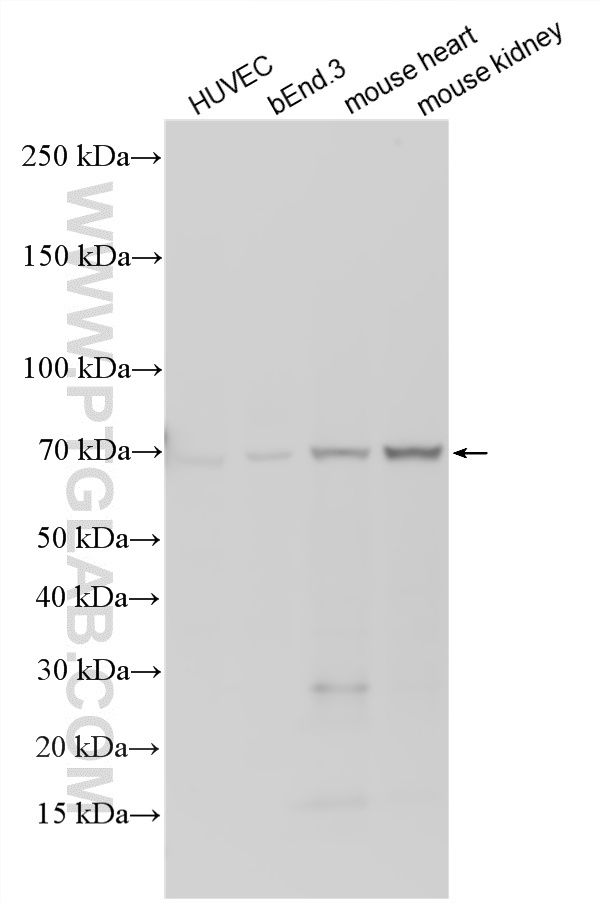 WB analysis using 11828-1-AP WB analysis using 11828-1-AP