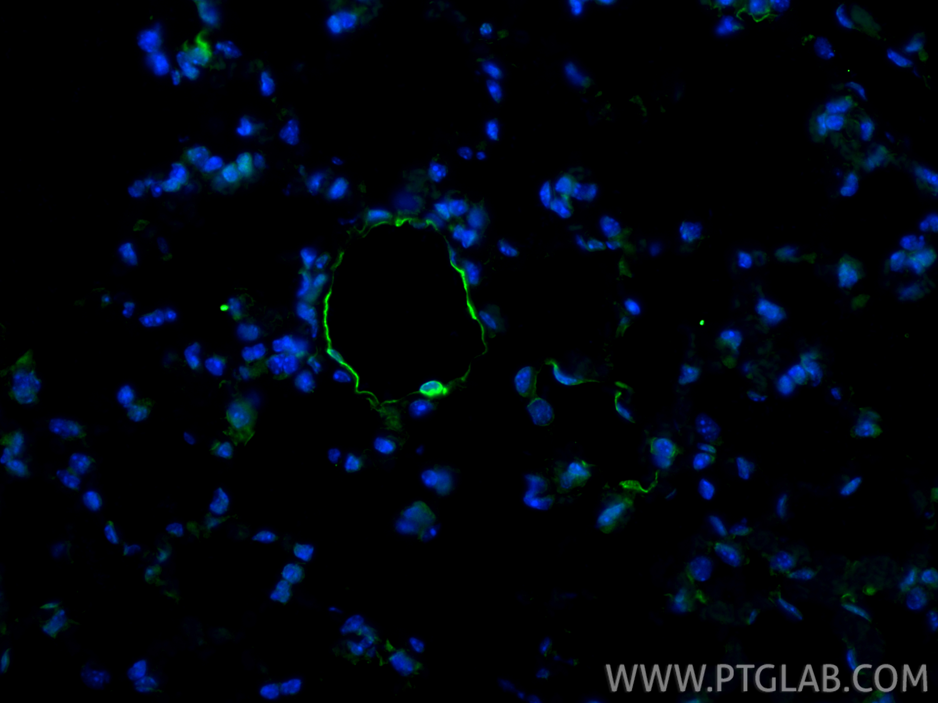 IF Staining of mouse lung using 34333-1-AP