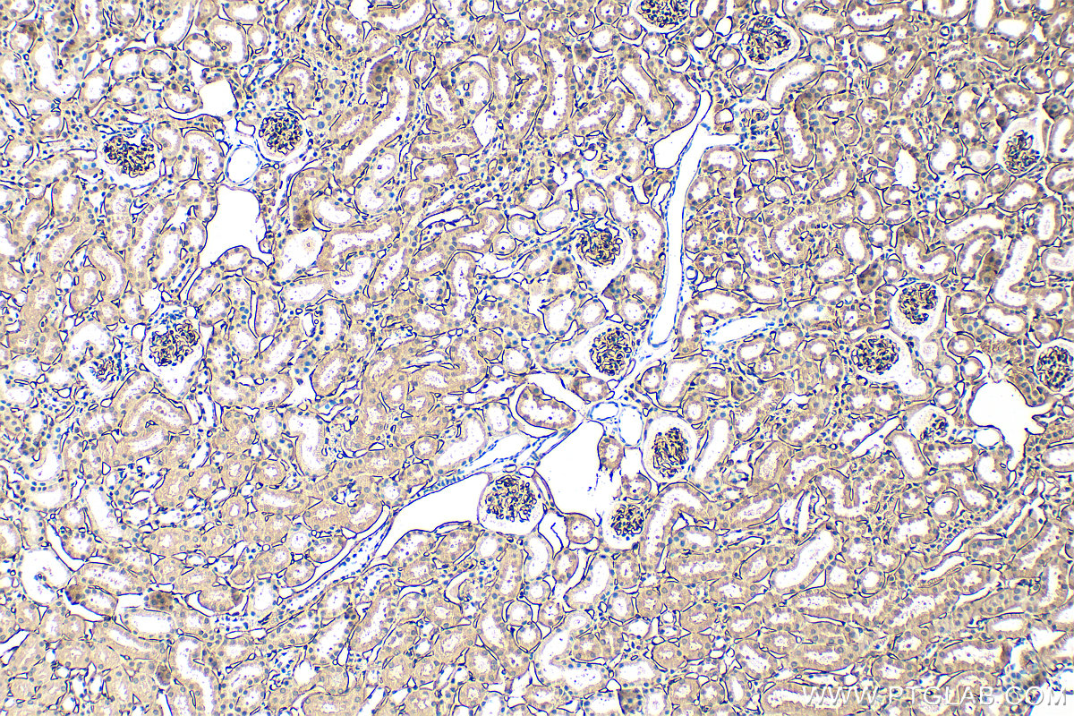 IHC staining of mouse kidney using 34333-1-AP