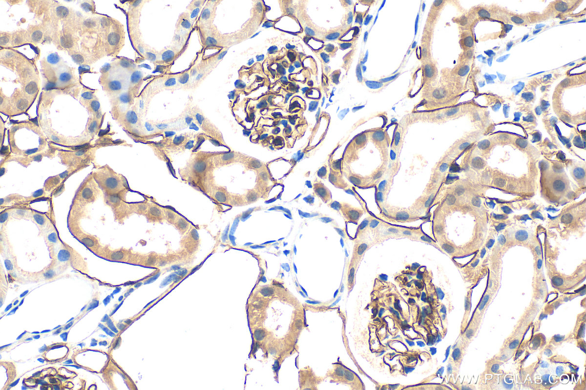 IHC staining of mouse kidney using 34333-1-AP