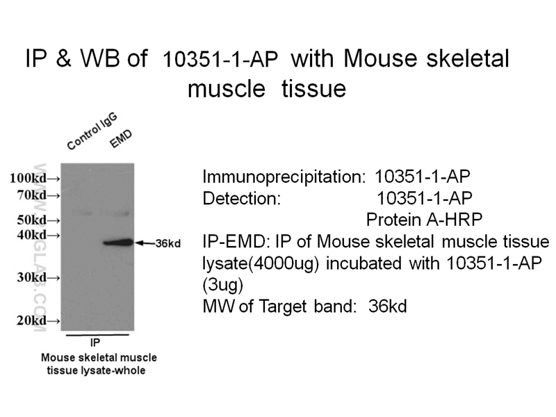 IP experiment of mouse skeletal muscle tissue using 10351-1-AP