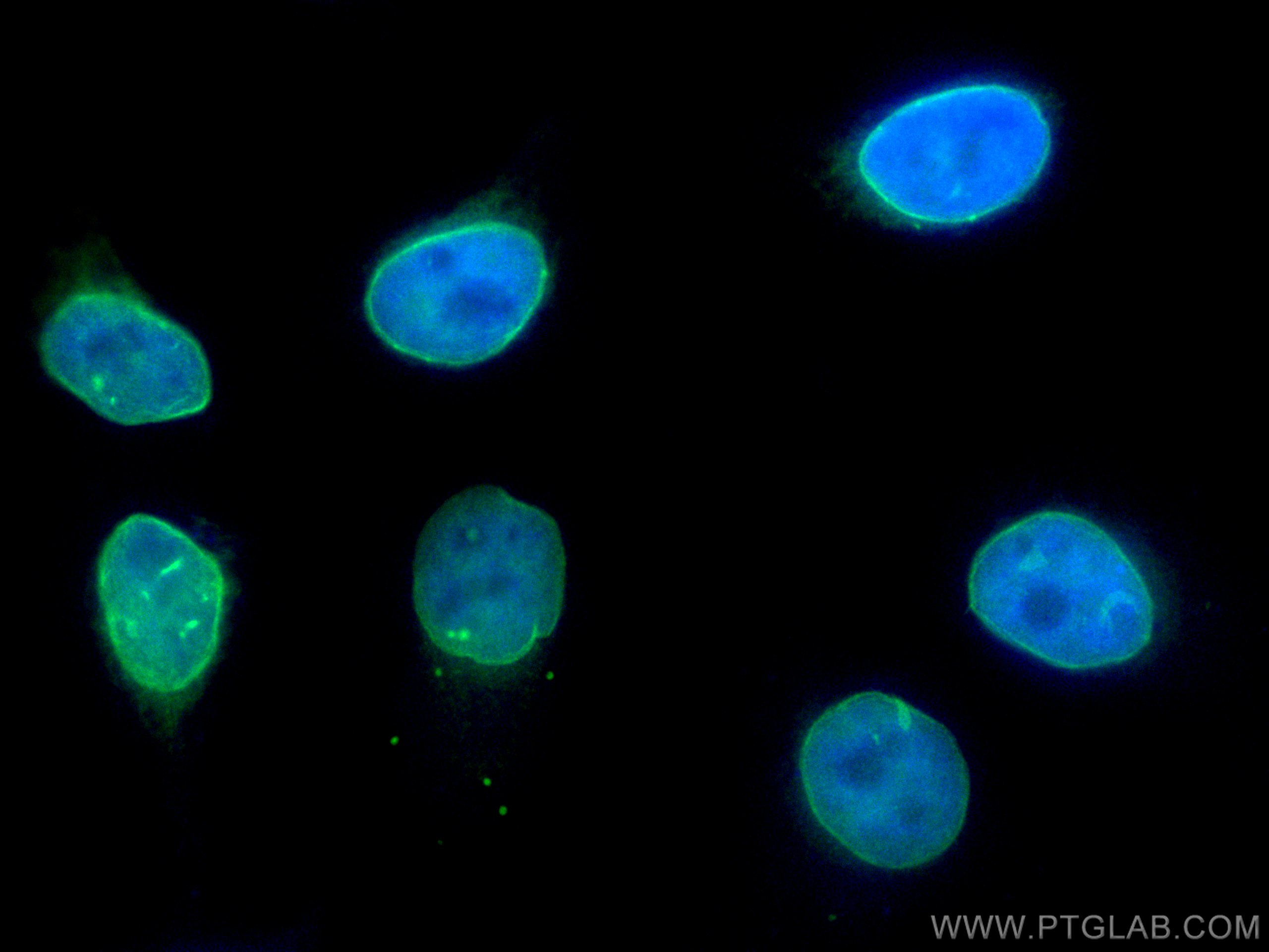 IF Staining of HeLa using 10351-1-AP