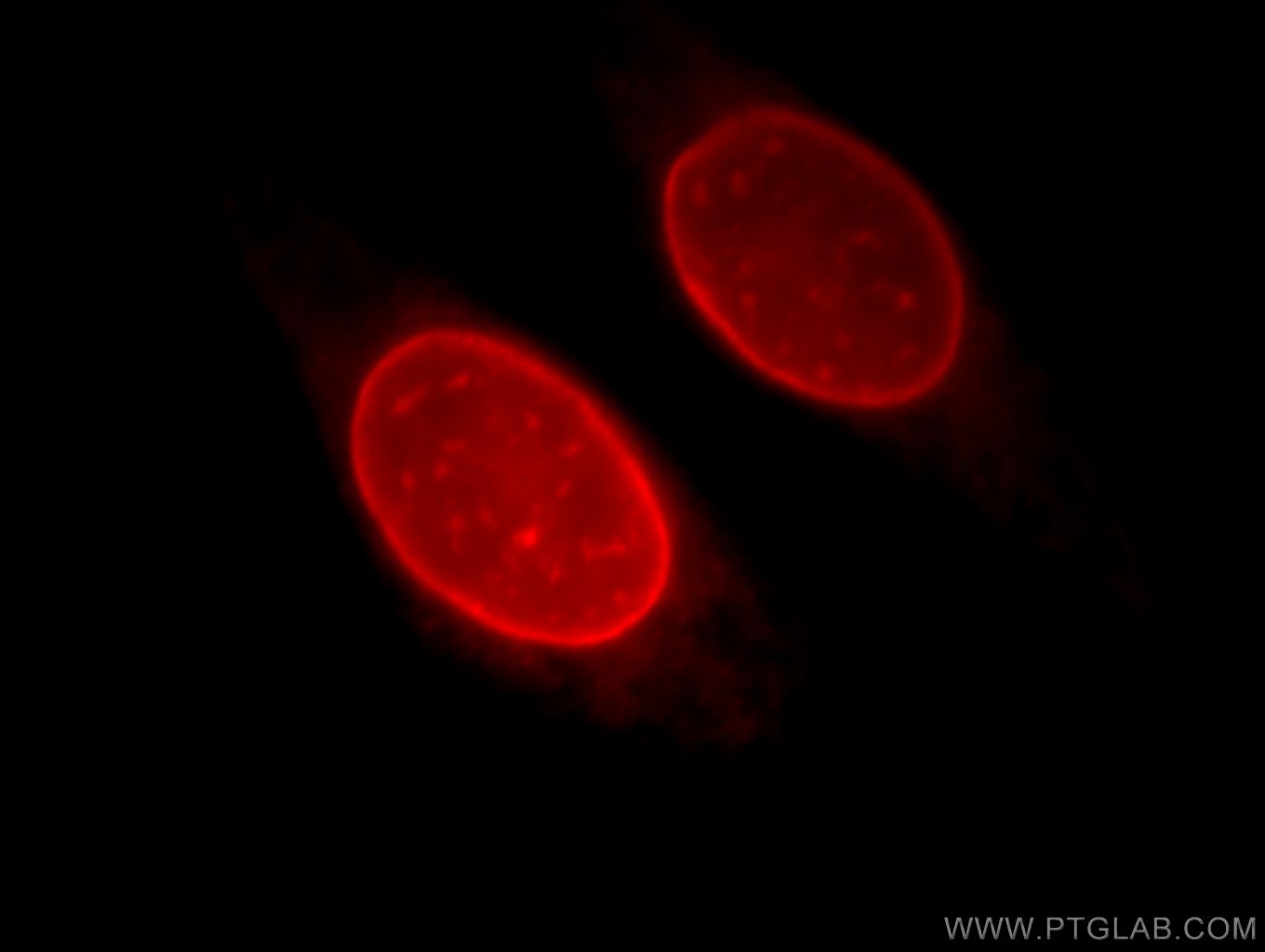 Emerin Polyclonal antibody