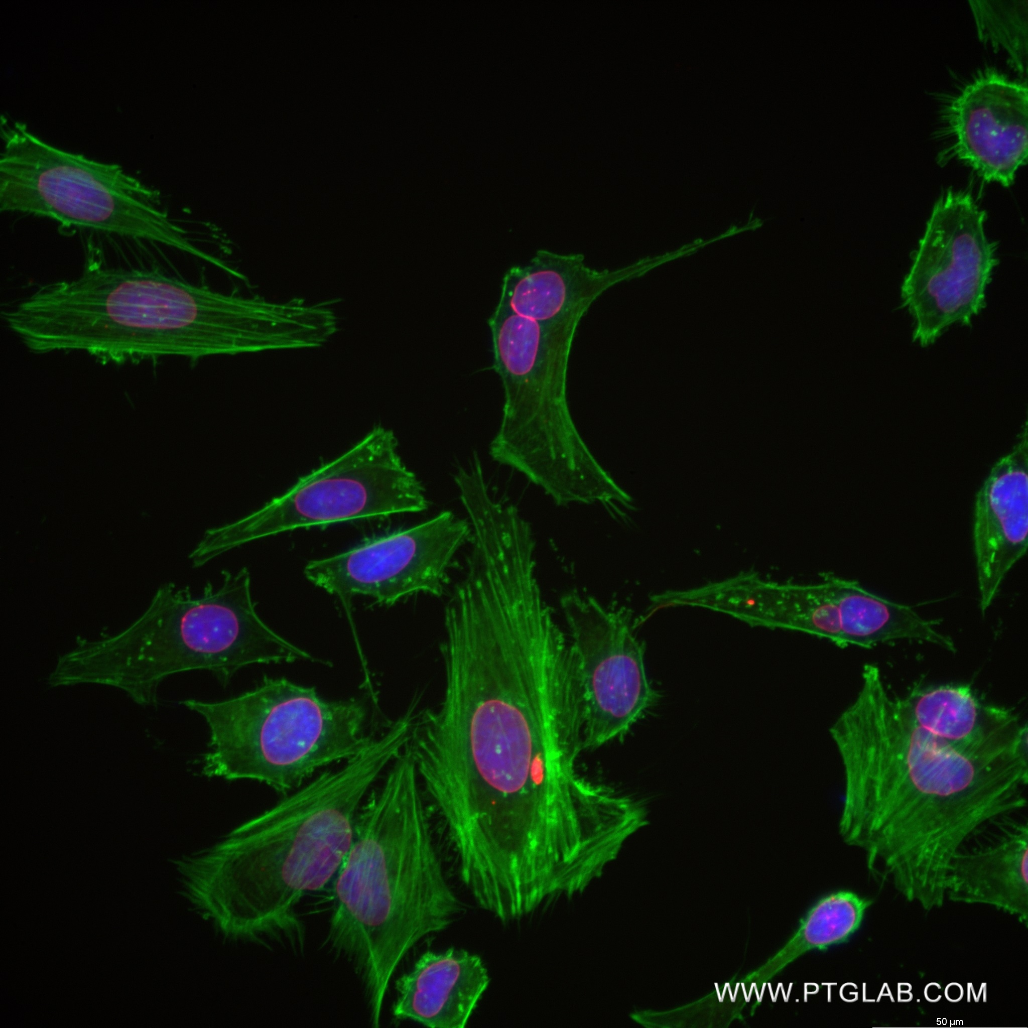 IF Staining of HeLa using 82888-1-RR (same clone as 82888-1-PBS)