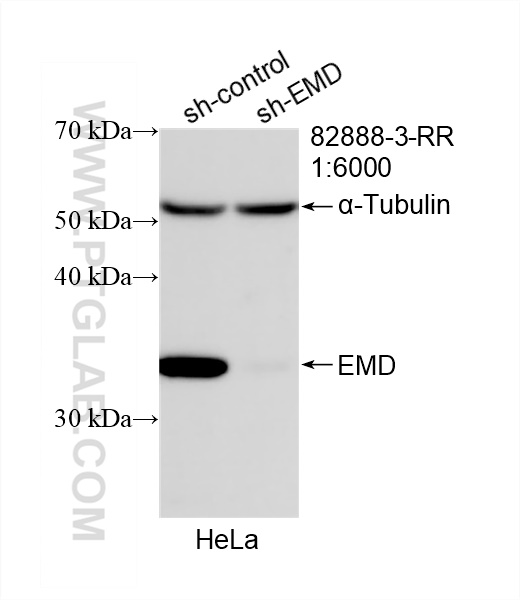 WB analysis of HeLa using 82888-3-RR (same clone as 82888-3-PBS)