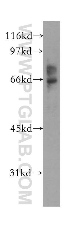 WB analysis of A375 using 12975-1-AP (same clone as 12975-1-PBS)