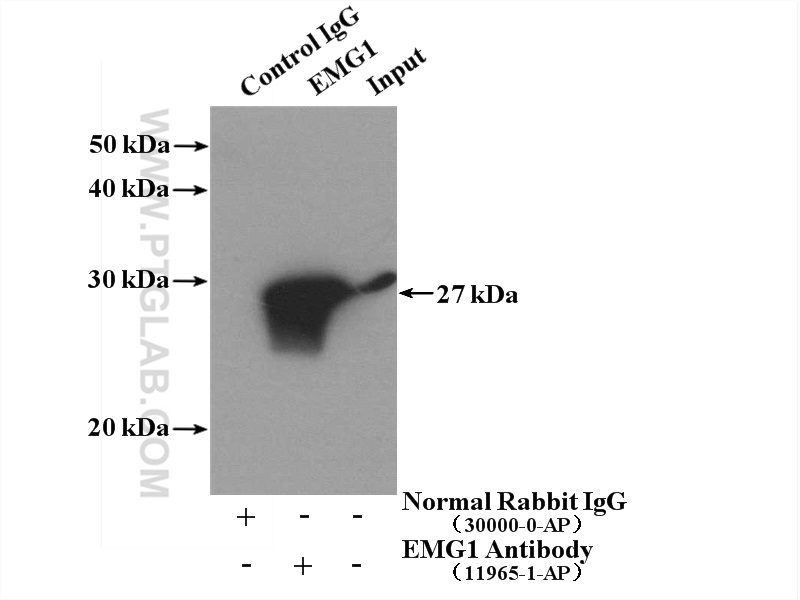 IP experiment of HeLa using 11965-1-AP