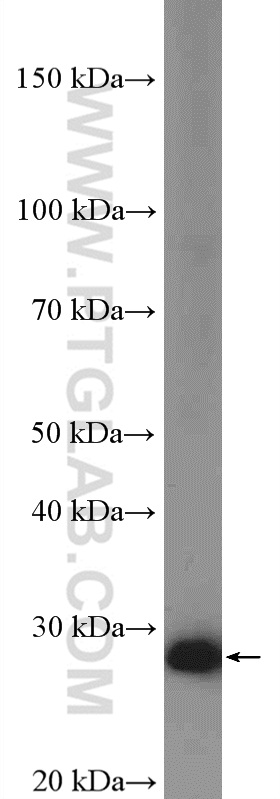 WB analysis of HEK-293 using 11965-1-AP