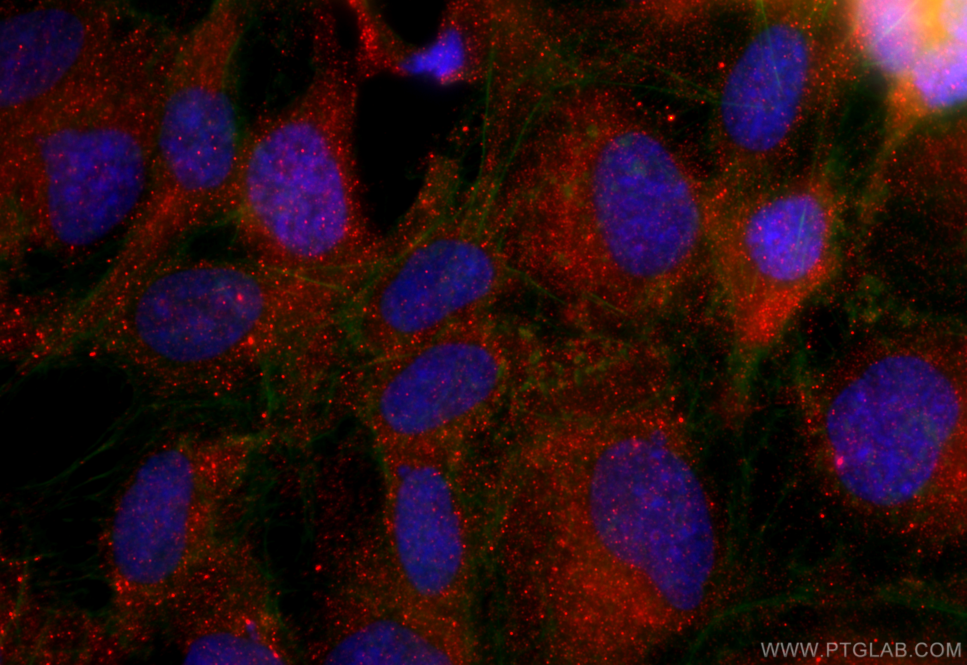 IF Staining of SKOV-3 using 10643-1-AP