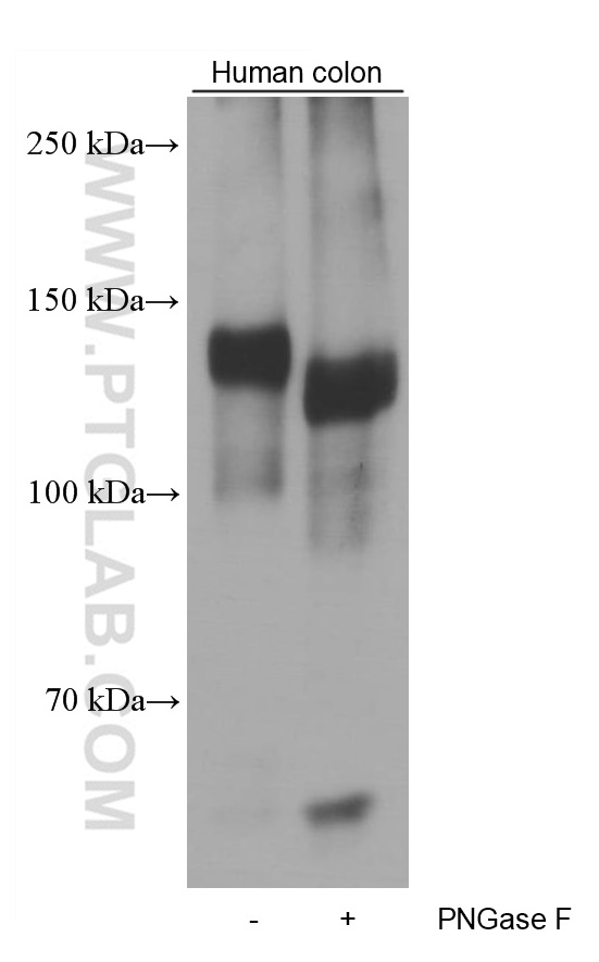 WB analysis of human colon using 60047-1-Ig