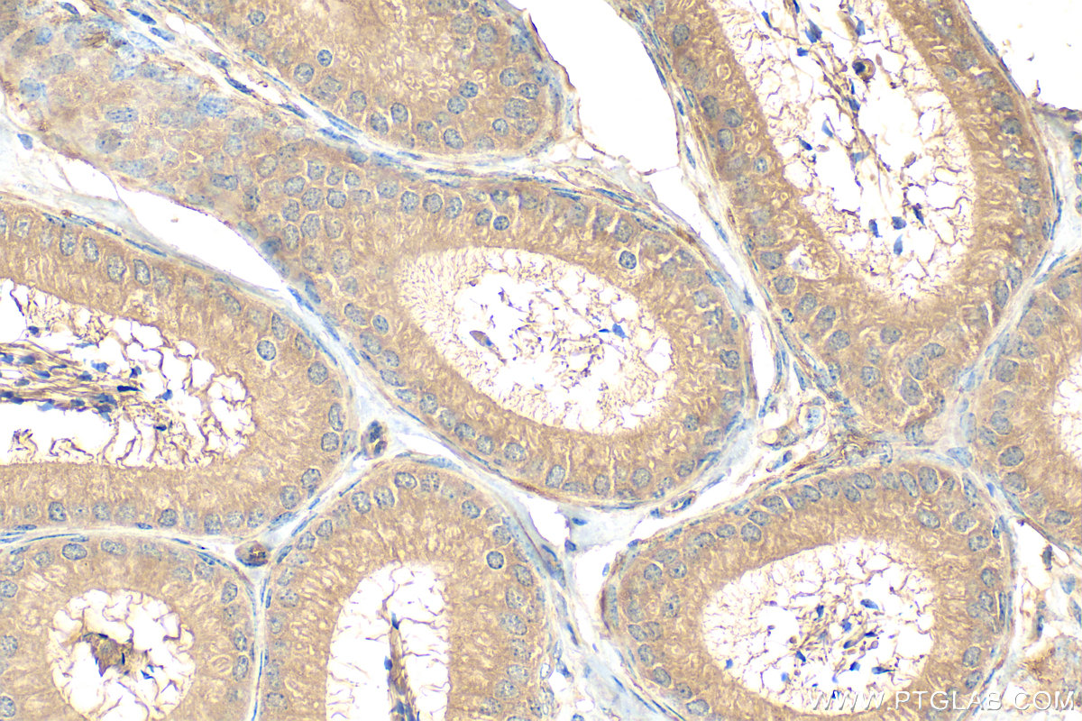 Immunohistochemical analysis of paraffin-embedded mouse testis tissue slide using 21308-1-AP (EMILIN3 antibody) at dilution of 1:200 (under 40x lens). Heat mediated antigen retrieval with Tris-EDTA buffer (pH 9.0). IHC staining of mouse testis using 21308-1-AP