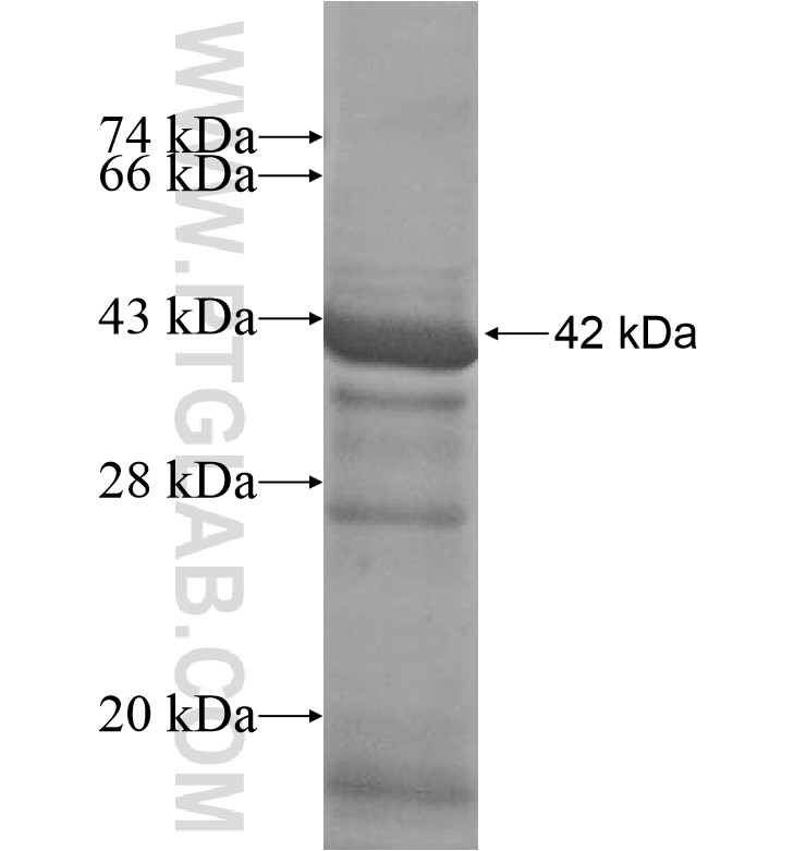 EMILIN3 fusion protein Ag16924 SDS-PAGE EMILIN3 fusion protein Ag16924 SDS-PAGE