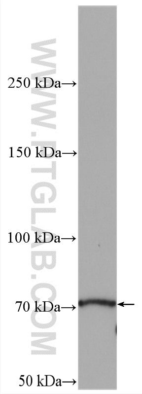 WB analysis of mouse heart using 13529-1-AP