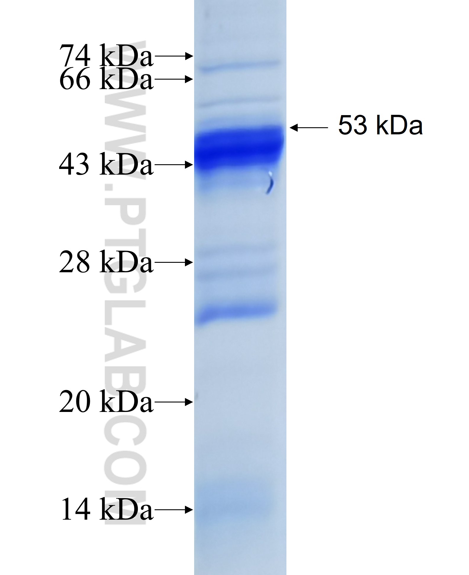 EML2 fusion protein Ag4634 SDS-PAGE