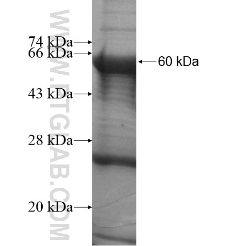 EML3 fusion protein Ag12500 SDS-PAGE EML3 fusion protein Ag12500 SDS-PAGE